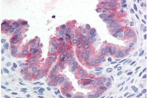 Human Uterus (formalin-fixed, paraffin-embedded) stained with c-Met antibody ABIN351534 at 10 ug/ml followed by biotinylated anti-mouse IgG secondary antibody ABIN481714, alkaline phosphatase-streptavidin and chromogen. (c-MET Antikörper  (Cytoplasmic Domain))