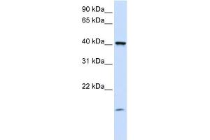 WB Suggested Anti-TMEM79 Antibody Titration:  0. (TMEM79 Antikörper  (C-Term))