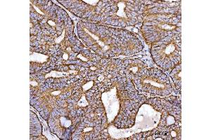 IHC analysis of NDUFS2 using anti-NDUFS2 antibody (ABIN7599417).