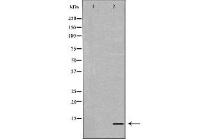 Western blot analysis of extracts of Jurkat, using MIF antibody. (MIF Antikörper  (C-Term))