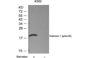 Western blot analysis of extracts from K562 cells untreated or treated with starvation using Stathmin 1(Phospho-Ser38) Antibody. (Stathmin 1 Antikörper  (pSer38))