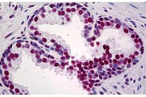 Human Prostate: Formalin-Fixed, Paraffin-Embedded (FFPE) (KAP1 Antikörper  (AA 379-524))