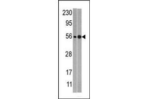 Western blot analysis of anti-NMD3 Pab (ABIN388665 and ABIN2838600) in mouse heart (left) and T47D (right)tissue lysates (35 μg/lane).