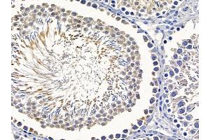 ABIN6258257 and ABIN6275216 at 1/100 staining rat testis tissue by IHC-P.