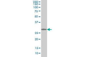 MMP26 monoclonal antibody (M01), clone 6C6 Western Blot analysis of MMP26 expression in HL-60 .