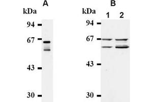 Western Blotting (WB) image for anti-Cell Division Cycle 25 Homolog A (S. Pombe) (CDC25A) antibody (ABIN487482) (CDC25A Antikörper)