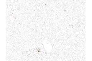 Immunohistochemistry (IHC) image for anti-Insulinoma-Associated 1 (INSM1) (AA 75-125) antibody (ABIN7795670)