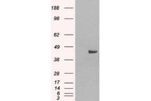 Western Blotting (WB) image for anti-Sorting Nexin 16 (SNX16) (N-Term) antibody (ABIN2466293) (SNX16 Antikörper  (N-Term))