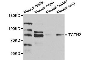 Western blot analysis of extract of various cells, using TCTN2 antibody. (TCTN2 Antikörper)