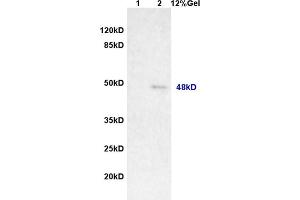 Lane 1: rat brain lysates Lane 2: human colon carcinoma lysates probed with Anti MAGEA11 Polyclonal Antibody, Unconjugated (ABIN721285) at 1:200 in 4 °C. (MAGEA11 Antikörper  (AA 12-120))