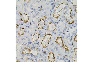 Immunohistochemistry of paraffin-embedded mouse kidney using STX1A antibody (ABIN5995405) (40x lens). (STX1A Antikörper)