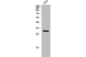 Western Blot analysis of COLO cells using Rab 6A Polyclonal Antibody