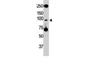 The Tlr5 polyclonal antibody  is used in Western blot to detect TLR5 in HL-60 cell lysate. (TLR5 Antikörper  (C-Term))