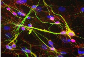 Mixed rat neuron-glial cultures stained with ABIN1842228, polyclonal antibody to -synuclein (red) and monoclonal antibody to MAP2: MAP2-4H5 (green). (SNCA Antikörper)