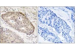 Immunohistochemistry (IHC) image for anti-Calcium Responsive Transcription Factor (CARF) (AA 311-360) antibody (ABIN2890117) (Calcium Responsive Transcription Factor (CARF) (AA 311-360) Antikörper)