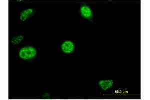 Immunofluorescence of monoclonal antibody to CDC20B on HeLa cell. (CDC20B Antikörper  (AA 416-515))