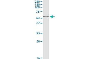 Immunoprecipitation (IP) image for anti-Lamin A/C (LMNA) (AA 1-664) antibody (ABIN517538)