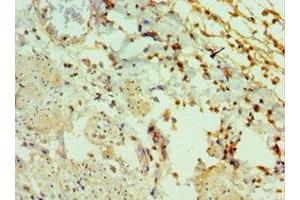 Immunohistochemistry of paraffin-embedded human epityphlon tissue using ABIN7153430 at dilution of 1:100 (GAL Antikörper  (AA 20-123))