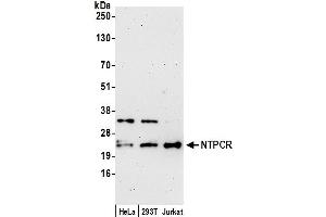 anti-Nucleoside-Triphosphatase, Cancer-Related (NTPCR) (AA 140-190) antibody