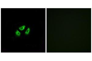 Immunofluorescence analysis of A549 cells, using SCN7A antibody.