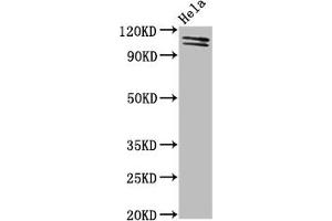Western Blot Positive WB detected in: Hela whole cell lysate All lanes: UBA1 antibody at 2 μg/mL Secondary Goat polyclonal to rabbit IgG at 1/50000 dilution Predicted band size: 118, 114 kDa Observed band size: 118, 114 kDa