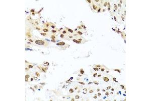 Immunohistochemistry (Paraffin-embedded Sections) (IHC (p)) image for anti-RAB3A Interacting Protein (Rabin3) (RAB3IP) (AA 1-150) antibody (ABIN6146588)