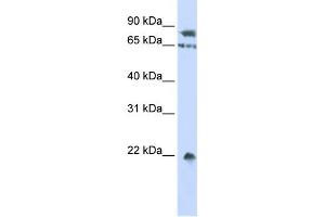 WB Suggested Anti-SENP1 Antibody Titration: 0. (SENP1 Antikörper  (Middle Region))