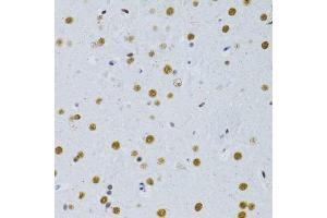 Immunohistochemistry of paraffin-embedded rat brain using SNRNP70 antibody. (SNRNP70 Antikörper  (AA 150-250))