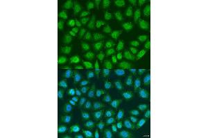 Immunofluorescence analysis of U2OS cells using SOCS4 antibody. (SOCS4 Antikörper  (AA 1-270))