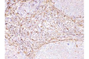 IHC analysis of Cyclophilin B using anti-Cyclophilin B antibody . (PPIB Antikörper  (AA 158-216))