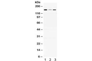 Western blot testing of 1) rat brain, 2) mouse liver and 3) human HepG2 lysate with ADAMTS13 antibody at 0. (ADAMTS13 Antikörper)