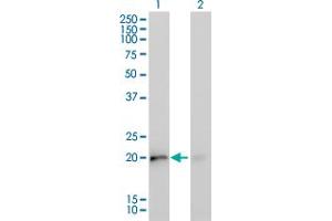 Western Blot analysis of KRAS expression in transfected 293T cell line by KRAS monoclonal antibody (M02), clone 4F3.