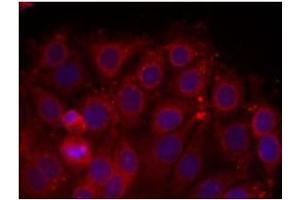 Image no. 2 for anti-VEGF Receptor 2 (VEGFR2) (Tyr1175) antibody (ABIN197237) (VEGFR2/CD309 Antikörper  (Tyr1175))