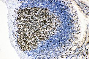 Immunohistochemistry (IHC) image for anti-Minichromosome Maintenance Complex Component 2 (MCM2) (AA 884-904), (C-Term) antibody (ABIN3044274)
