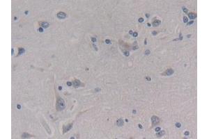 Detection of MEAI in Human Cerebrum Tissue using Polyclonal Antibody to Menin (MEAI) (Menin Antikörper  (AA 219-395))