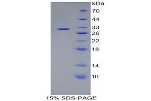 SDS-PAGE (SDS) image for Kallikrein 1 (KLK1) (AA 21-261) protein (His tag) (ABIN1980873) (Kallikrein 1 Protein (KLK1) (AA 21-261) (His tag))
