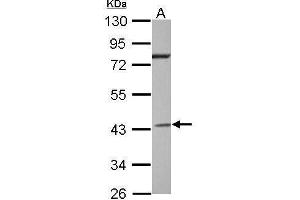 WB Image Sample (30 ug of whole cell lysate) A: Jurkat 10% SDS PAGE antibody diluted at 1:2000 (GNAI2 Antikörper  (Center))