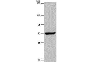 Western blot analysis of K562 cell, using ZC3H12A Polyclonal Antibody at dilution of 1:200