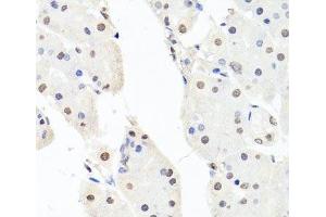Immunohistochemistry of paraffin-embedded Human stomach using CHRAC1 Polyclonal Antibody at dilution of 1:100 (40x lens). (CHRAC1 Antikörper)