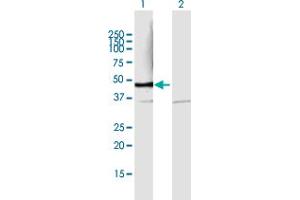 Western Blotting (WB) image for anti-Proteasome (Prosome, Macropain) 26S Subunit, Non-ATPase, 6 (PSMD6) (AA 1-389) antibody (ABIN948861)