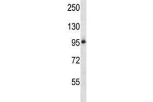 Integrin beta 5 antibody western blot analysis in NCI-H460 lysate. (Integrin beta 5 Antikörper  (AA 216-244))