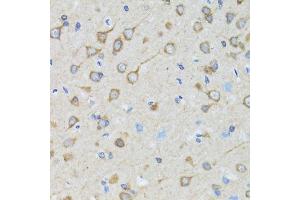 Immunohistochemistry (Paraffin-embedded Sections) (IHC (p)) image for anti-Toll Interacting Protein (TOLLIP) (AA 1-274) antibody (ABIN3023652)