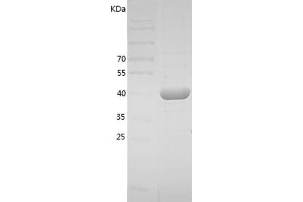 PAI1 Protein (AA 24-402) (His tag)