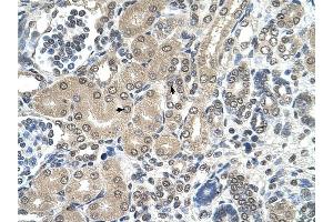 RRP1 antibody was used for immunohistochemistry at a concentration of 4-8 ug/ml to stain Epithelial cells of renal tubule (arrows) in Human Kidney. (RRP1 Antikörper)