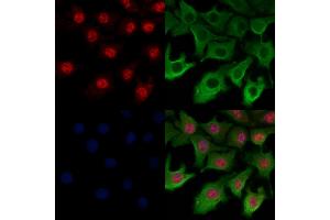 ABIN6259300 and ABIN6274312 staining Hela cells by IF/ICC.