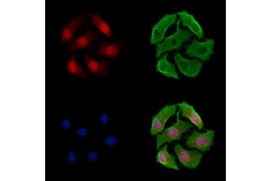 ABIN7093407 and ABIN7097429 staining Hela cells by IF/ICC. (CRTC2 Antikörper)