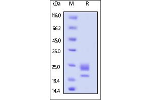 SDS-PAGE (SDS) image for Tumor Necrosis Factor (Ligand) Superfamily, Member 4 (TNFSF4) (AA 49-198) (Active) protein (His tag) (ABIN6253698)