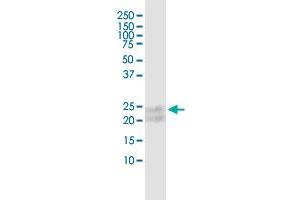 TNFRSF17 (Human) IP-WB Antibody Pair