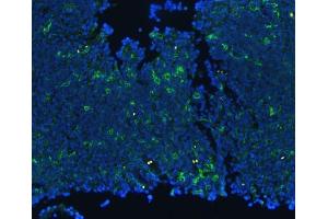IF analysis of CD18/ITGB2 using anti-CD18/ITGB2 antibody (ABIN3043260).