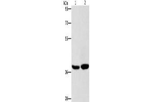 Gel: 8 % SDS-PAGE, Lysate: 40 μg, Lane 1-2: Human fetal brain tissue, 231 cells, Primary antibody: ABIN7128713(CAB39L Antibody) at dilution 1/400, Secondary antibody: Goat anti rabbit IgG at 1/8000 dilution, Exposure time: 15 seconds (CAB39L Antikörper)
